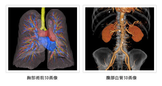 胸部術後3D画像/頭部血管3D画像